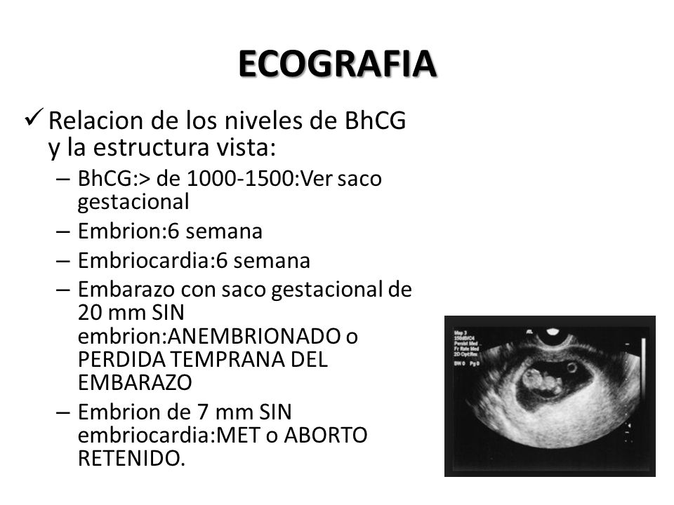 Embarazo 7 semanas sin embrion